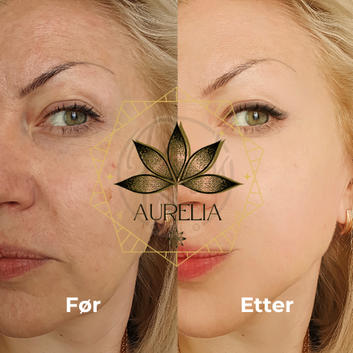 Magisk Hudolje for Glød